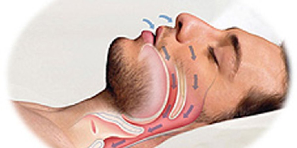 Храп, который убивает: как остановка дыхания во сне заставляет сердце стареть на глазах Храп, который убивает: как остановка дыхания во сне заставляет сердце стареть на глазах